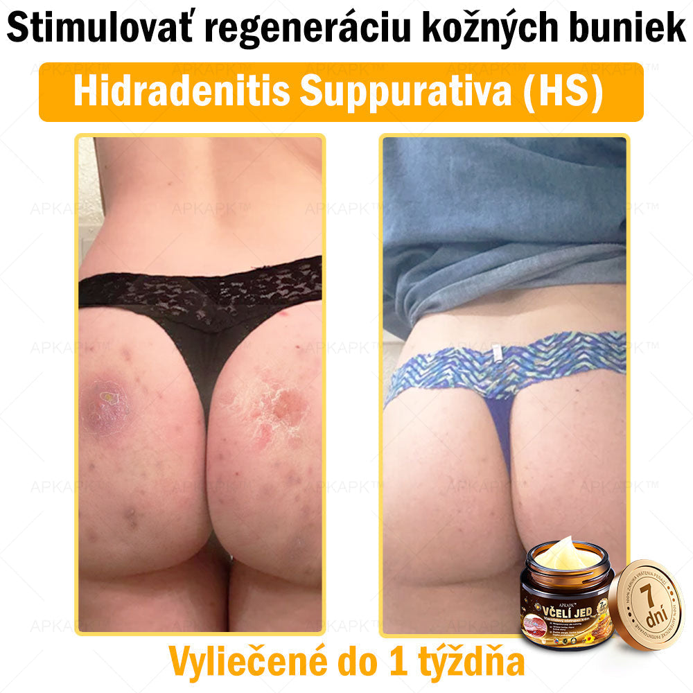 Zostalo už len 5 plechoviek! Ponúkame 50 % extra zľavu! Udržujte svoju pleť zdravú. Ak to teraz zmeškáte, budete mať šancu až budúci rok!