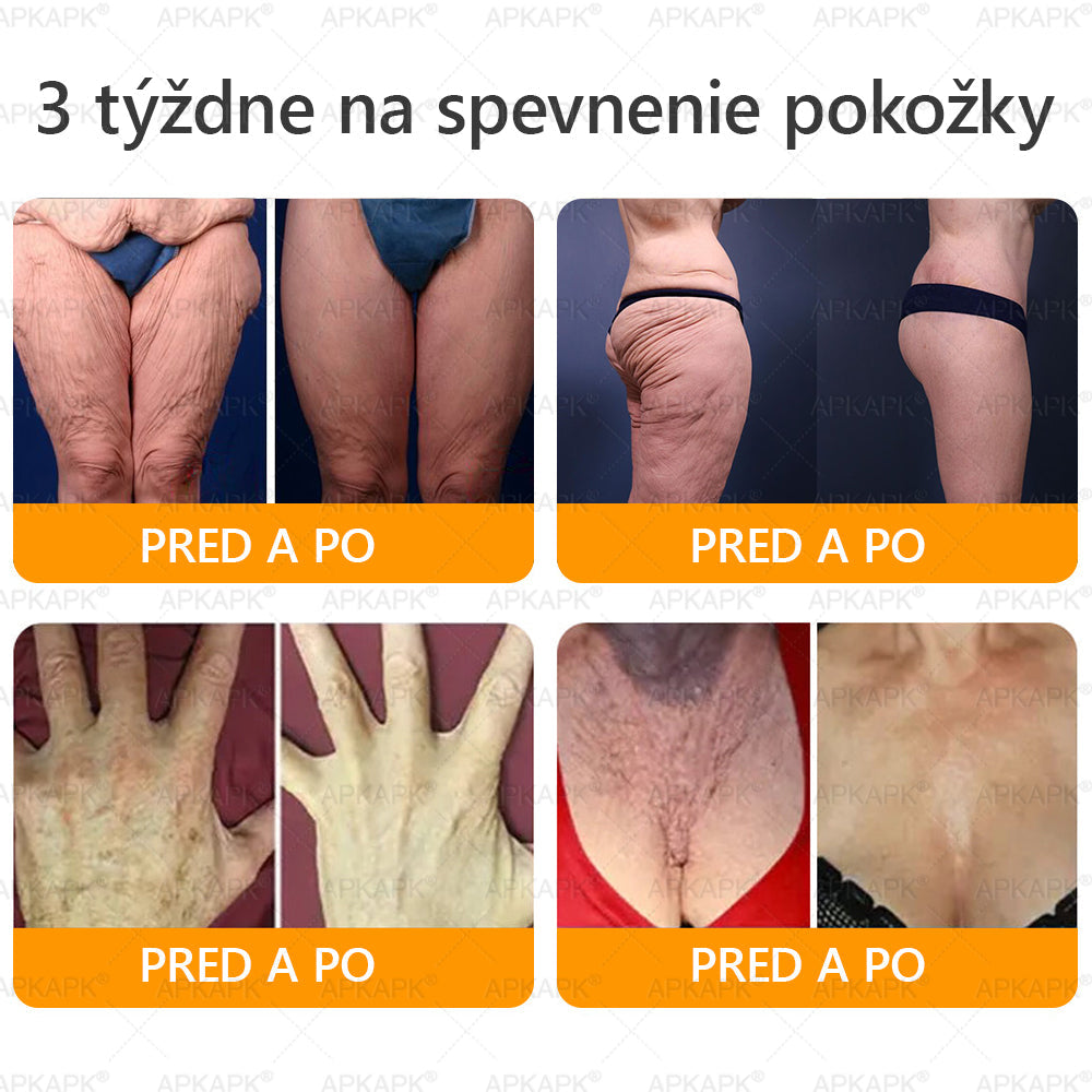 ⏰Zostáva už len 5 balení na sklade! Ponúkame dodatočnú zľavu 50 %! Zdravšie telo je na dosah! Ak to teraz premeškáte, budete musieť na ďalšiu príležitosť počkať až do budúceho roka!⏰𝖠𝖯𝖪𝖠𝖯𝖪®