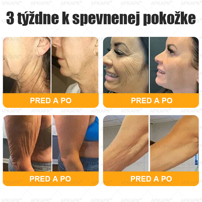⏰Zostáva už len 5 balení na sklade! Ponúkame dodatočnú zľavu 50 %! Zdravšie telo je na dosah! Ak to teraz premeškáte, budete musieť na ďalšiu príležitosť počkať až do budúceho roka!⏰𝖠𝖯𝖪𝖠𝖯𝖪®