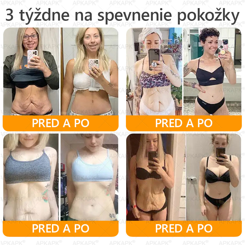 ⏰Zostáva už len 5 balení na sklade! Ponúkame dodatočnú zľavu 50 %! Zdravšie telo je na dosah! Ak to teraz premeškáte, budete musieť na ďalšiu príležitosť počkať až do budúceho roka!⏰𝖠𝖯𝖪𝖠𝖯𝖪®