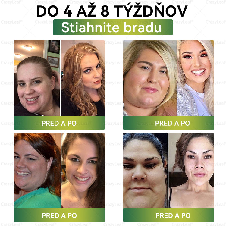⏰Zostáva už len 5 balení na sklade! Ponúkame dodatočnú zľavu 50 %! Zdravšie telo je na dosah! Ak to teraz premeškáte, budete musieť na ďalšiu príležitosť počkať až do budúceho roka!⏰