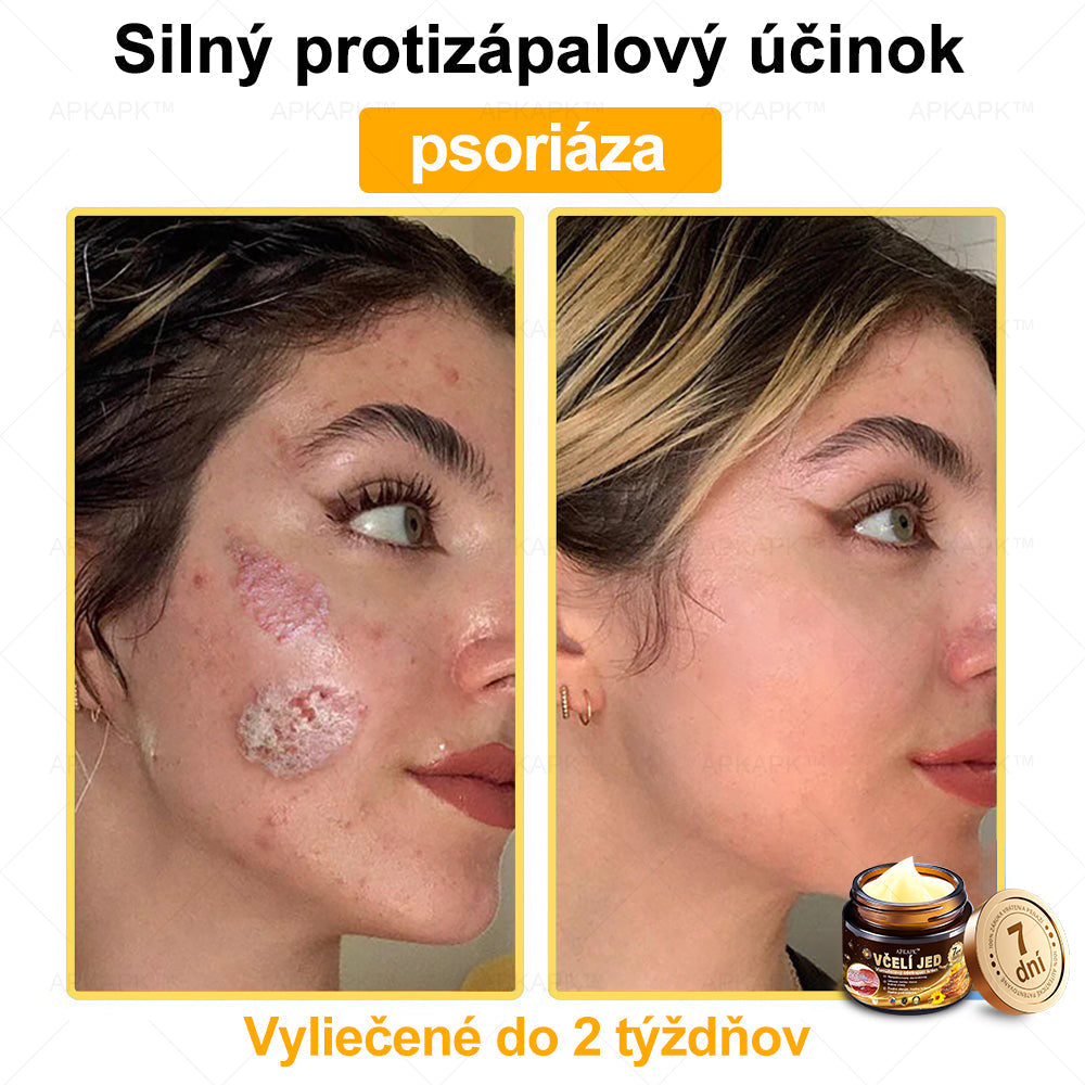 Zostalo už len 5 plechoviek! Ponúkame 50 % extra zľavu! Udržujte svoju pleť zdravú. Ak to teraz zmeškáte, budete mať šancu až budúci rok!
