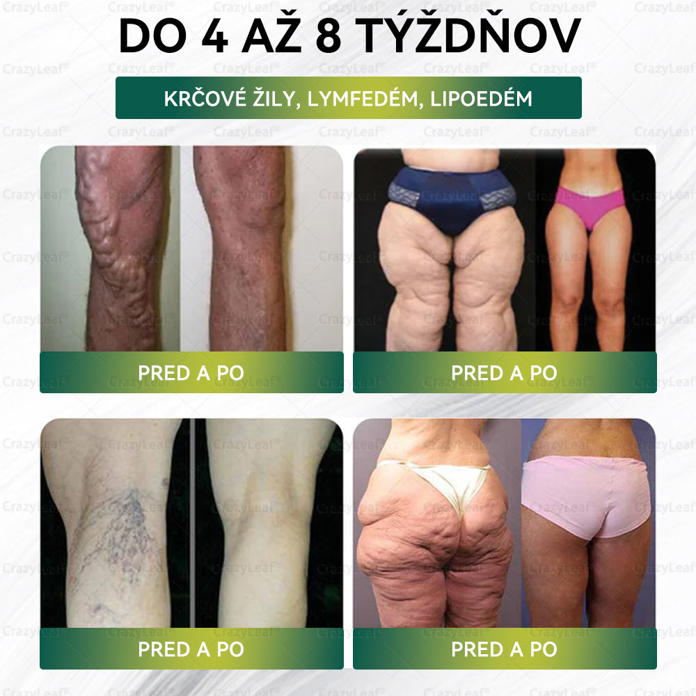 ⏰Zostáva už len 5 balení na sklade! Ponúkame dodatočnú zľavu 50 %! Zdravšie telo je na dosah! Ak to teraz premeškáte, budete musieť na ďalšiu príležitosť počkať až do budúceho roka!⏰