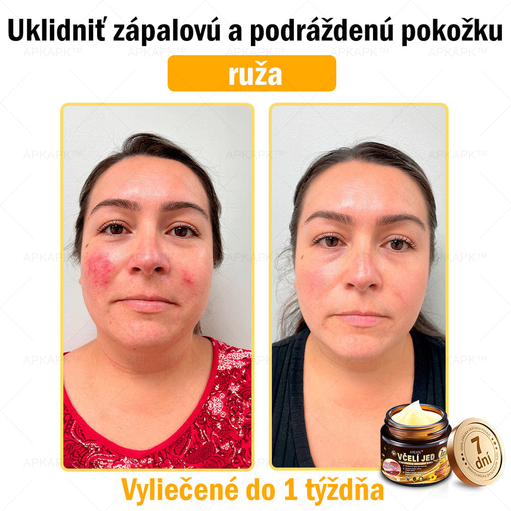 Zostalo už len 5 plechoviek! Ponúkame 50 % extra zľavu! Udržujte svoju pleť zdravú. Ak to teraz zmeškáte, budete mať šancu až budúci rok!