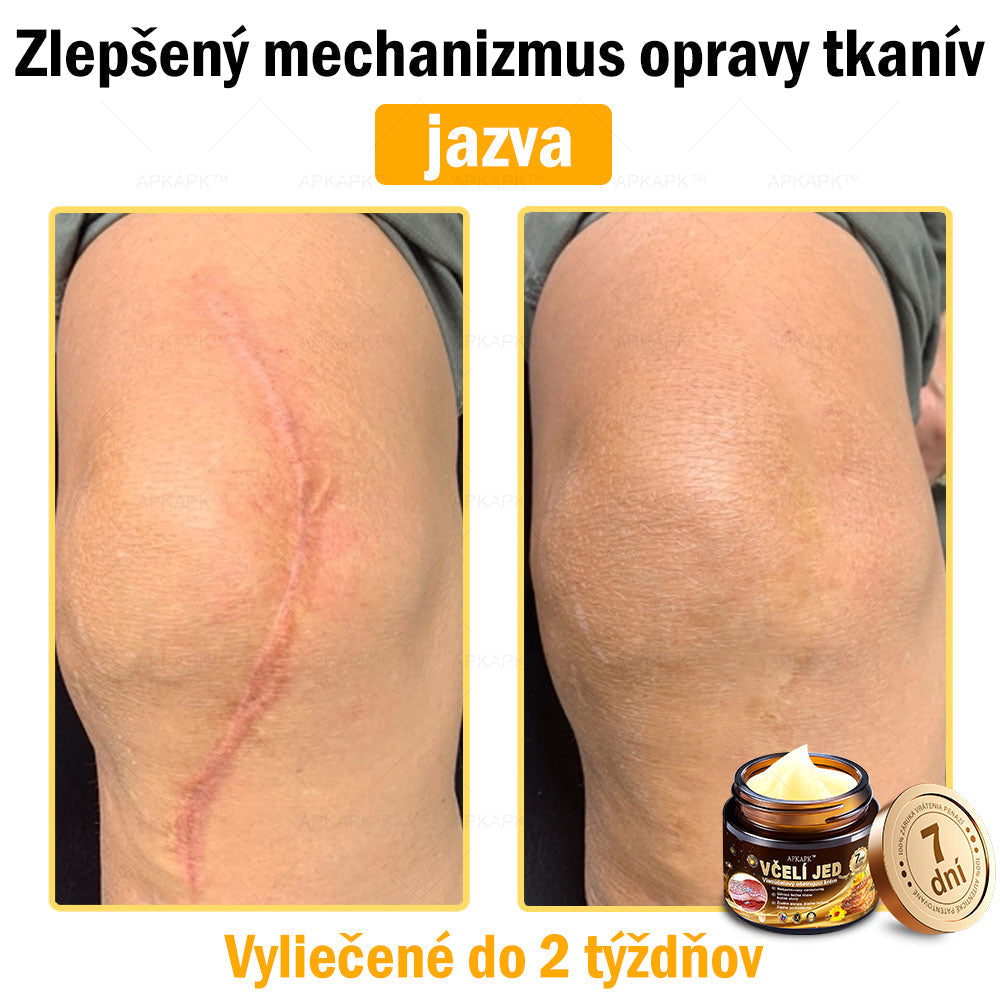 Zostalo už len 5 plechoviek! Ponúkame 50 % extra zľavu! Udržujte svoju pleť zdravú. Ak to teraz zmeškáte, budete mať šancu až budúci rok!