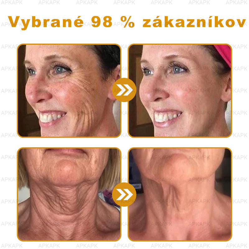 Zostalo už len 5 plechoviek! Ponúkame 50 % extra zľavu! Udržujte svoju pleť zdravú. Ak to teraz zmeškáte, budete mať šancu až budúci rok!