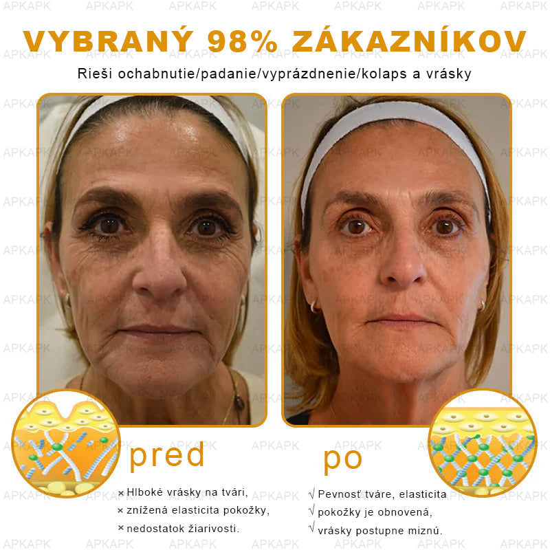 Zostalo už len 5 plechoviek! Ponúkame 50 % extra zľavu! Udržujte svoju pleť zdravú. Ak to teraz zmeškáte, budete mať šancu až budúci rok!