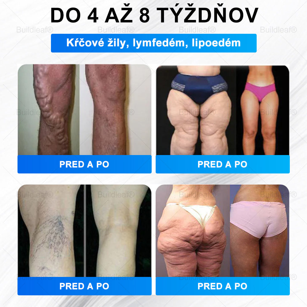 ⏰Posledná šanca! Uchmatnite si tento šťastný úlovok so zľavou 50 %!⏰