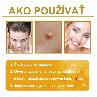 Zostalo už len 5 plechoviek! Ponúkame 50 % extra zľavu! Udržujte svoju pleť zdravú. Ak to teraz zmeškáte, budete mať šancu až budúci rok!