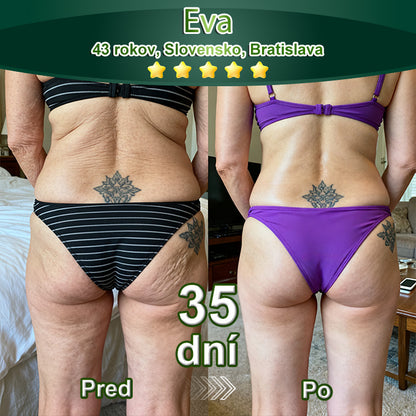 🧑‍⚕️🧑‍⚕️BuildLeaf® GLP-1 8-v-1 Fit & Vital Perorálny Roztok (Len raz denne, viditeľné zmeny už za 7 dní) Pre obezitu, kardiovaskulárne ochorenia, cukrovku, spánkové apnoe, zdravie čriev, problémy s kĺbmi a ďalšie