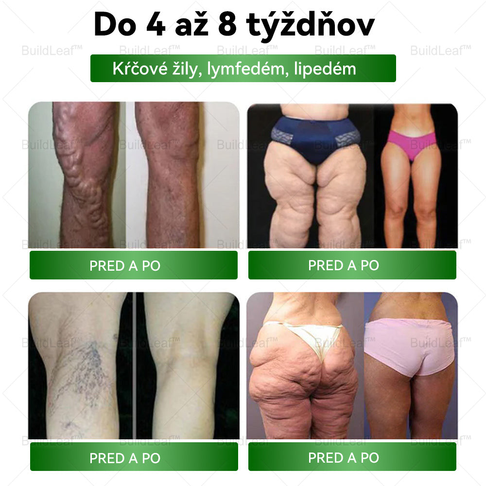👩‍⚕Odporúčané klinikou Mayo | Oficiálny obchod | BuildLeaf® GLP-1 Moringa Slimming & Health Boost Drops🔥 (Spaľovač tukov potravinárskej kvality – vyvinutý Spoločnosťou pre obezitu)