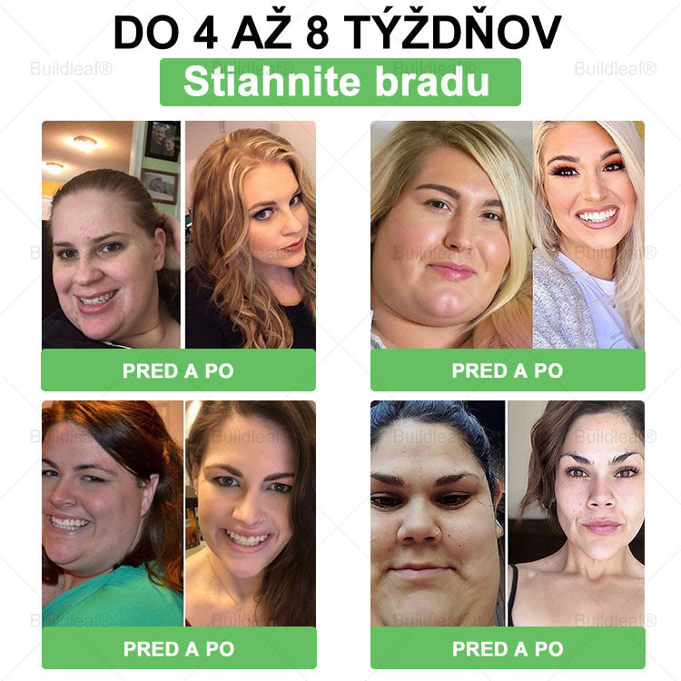 ⏰Zostáva už len pár balení na sklade! Využite extra zľavu -50 %! Štíhlejšia postava a viac energie sú na dosah! Ak to teraz premeškáte, ďalšia príležitosť príde až budúci rok!⏰ BuildLeaf®