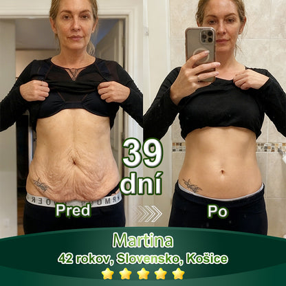 BuildLeaf® GLP-1 6-v-1 Health Solution Perorálna tekutina (Len raz denne, viditeľné zmeny už za 7 dní) Pre obezitu, kardiovaskulárne ochorenia, cukrovku, spánkové apnoe, zdravie čriev, problémy s kĺbmi a ďalšie