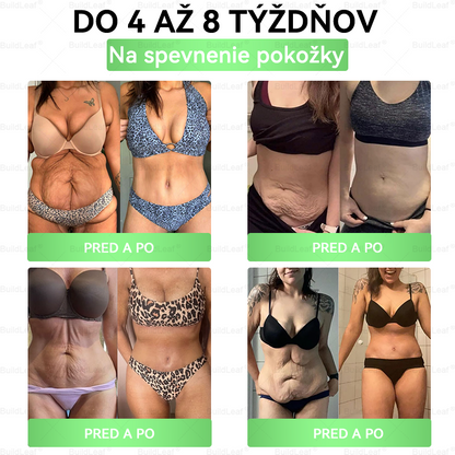 ✨BuildLeaf® GLP-1 6-v-1 Health Solution Perorálna tekutina (Len raz denne, viditeľné zmeny už za 7 dní) Pre obezitu, kardiovaskulárne ochorenia, cukrovku, spánkové apnoe, zdravie čriev, problémy s kĺbmi a ďalšie