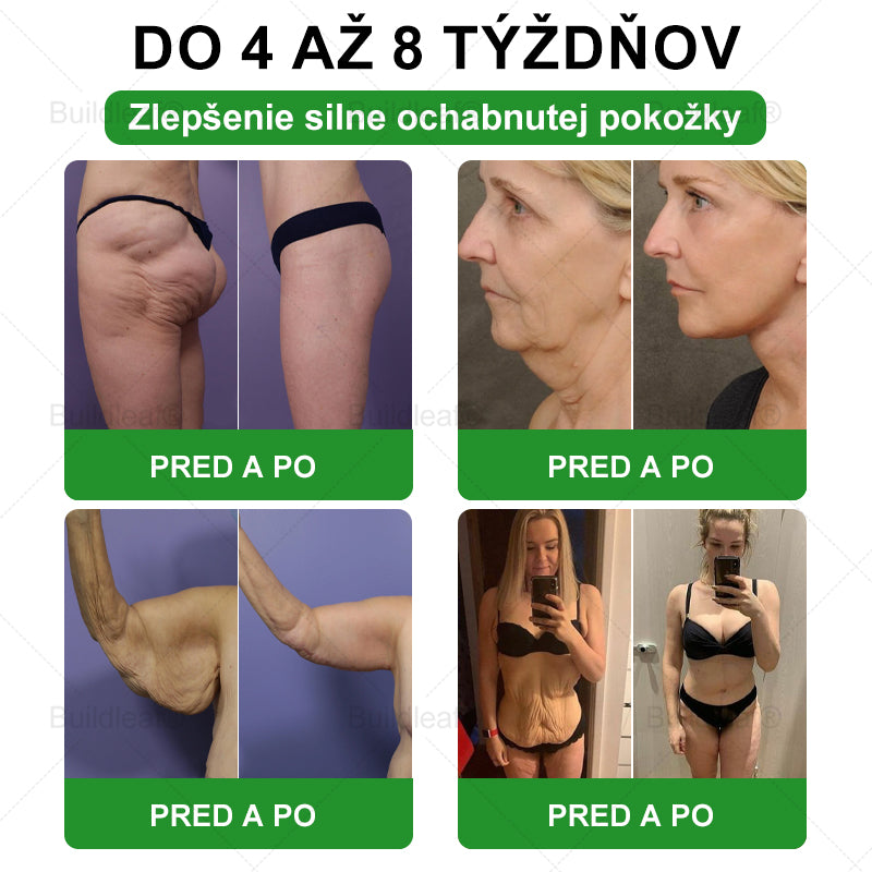 ⏰Zostáva už len pár balení na sklade! Využite extra zľavu -50 %! Štíhlejšia postava a viac energie sú na dosah! Ak to teraz premeškáte, ďalšia príležitosť príde až budúci rok!⏰ BuildLeaf®