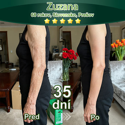 BuildLeaf® GLP-1 6-v-1 Health Solution Perorálna tekutina (Len raz denne, viditeľné zmeny už za 7 dní) Pre obezitu, kardiovaskulárne ochorenia, cukrovku, spánkové apnoe, zdravie čriev, problémy s kĺbmi a ďalšie