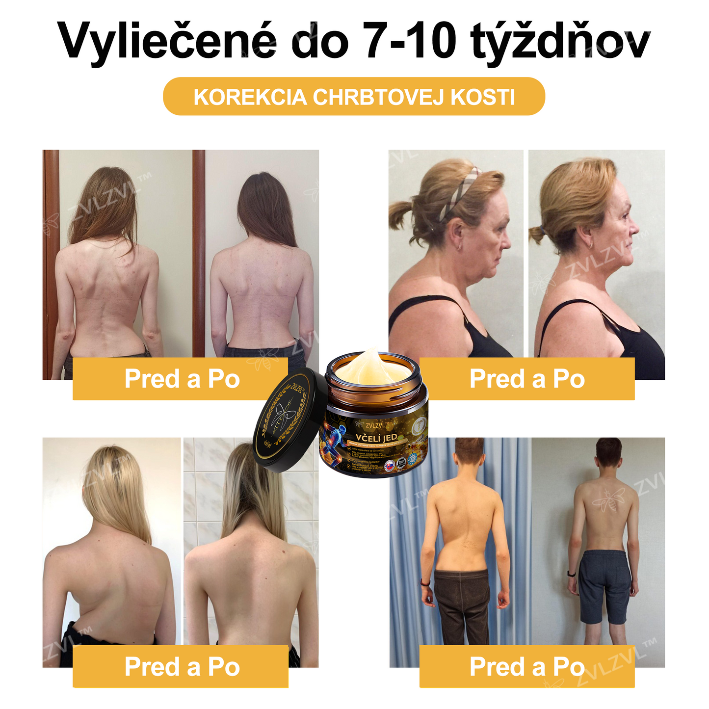 𝐙𝐕𝐋𝐙𝐕𝐋™  𝐕č𝐞𝐥í 𝐣𝐞𝐝 𝐨𝐤𝐚𝐦ž𝐢𝐭ý 𝐮𝐥𝐭𝐫𝐚 𝐬𝐢𝐥𝐧ý 𝐤𝐫é𝐦 𝐩𝐫𝐨𝐭𝐢 𝐛𝐨𝐥𝐞𝐬𝐭𝐢 - (𝐳𝐦𝐢𝐞𝐫ň𝐮𝐣𝐞 𝐛𝐨𝐥𝐞𝐬ť 𝐩𝐫𝐢 𝐚𝐫𝐭𝐫𝐢𝐭í𝐝𝐞, 𝐛𝐨𝐥𝐞𝐬𝐭𝐢 𝐬𝐯𝐚𝐥𝐨𝐯, 𝐜𝐡𝐫𝐛𝐭𝐚, 𝐤𝐨𝐥𝐢𝐞𝐧, 𝐜𝐡𝐫𝐛𝐭𝐚, 𝐫𝐚𝐦𝐢𝐞𝐧, 𝐛𝐨𝐤𝐨𝐯, 𝐳á𝐩ä𝐬𝐭í, 𝐫ú𝐤)