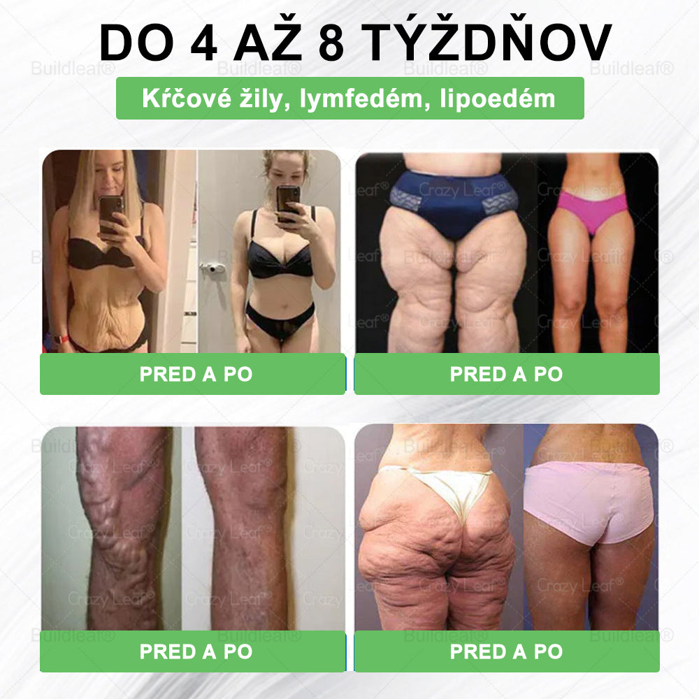 ⏰Zostáva už len pár balení na sklade! Využite extra zľavu -50 %! Štíhlejšia postava a viac energie sú na dosah! Ak to teraz premeškáte, ďalšia príležitosť príde až budúci rok!⏰ BuildLeaf®