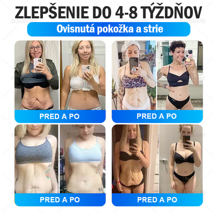 👩dporúčané klinikou Mayo | Buildleaf®🌿 Tirzepatidový zoštíhľujúci a zdravotný nano-mikroihlový náplasť🔥 Obezita, kardiovaskulárne ochorenia, cukrovka, spánkové apnoe, problémy s kĺbmi a ďalšie