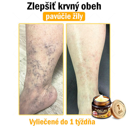 Zostalo už len 5 plechoviek! Ponúkame 50 % extra zľavu! Udržujte svoju pleť zdravú. Ak to teraz zmeškáte, budete mať šancu až budúci rok!