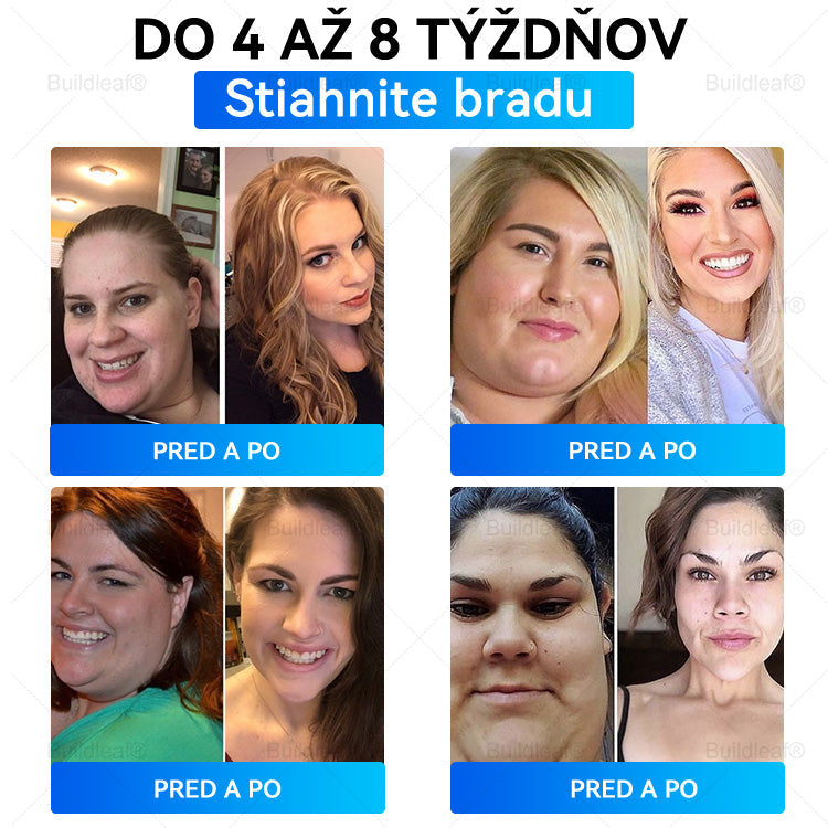 👩dporúčané klinikou Mayo | Buildleaf®🌿 Tirzepatidový zoštíhľujúci a zdravotný nano-mikroihlový náplasť🔥 Obezita, kardiovaskulárne ochorenia, cukrovka, spánkové apnoe, problémy s kĺbmi a ďalšie