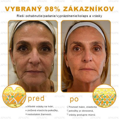 Zostalo už len 5 plechoviek! Ponúkame 50 % extra zľavu! Udržujte svoju pleť zdravú. Ak to teraz zmeškáte, budete mať šancu až budúci rok!